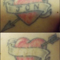 vanish laser tattoo removal and skin aesthetics vanish laser tattoo removal and skin aesthetics